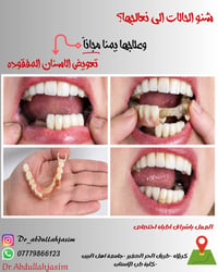 حشوات ضوئية • قلع اسنان • كلية طب الاسنان كربلاء