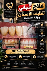 تنظيف أسنان • إزالة تكلسات • جامعة الإسراء