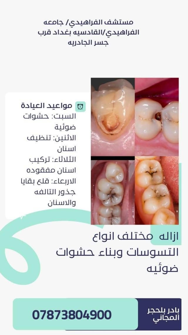 للاستفسار واتساب ***********

نص مكتوب في الصور:
- مستشفى الفراهيدي/ جامعه الفراهيدي/القادسيه بغداد قرب جسر الجادريه dr- Hajer لعلاج كافه مشاكل الاسنان بفحص وعلاج مجاني تحت اشراف نخبه من افضل الاطباء مواعيد العيادة السبت: حشوات ضوئية الاثنين: تنظيف اسنان الثلاثاء: تركيب اسنان مفقوده الاربعاء: قلع بقايا جذور التالفه والاسنان *********** بادر بالحجز المجاني
- مستشف الفراهيدي/ جامعه الفراهيدي/القادسيه بغداد قرب جسر الجادريه مواعيد العيادة السبت: حشوات ضوئية الاثنين: تنظيف اسنان الثلاثاء: تركيب اسنان مفقوده الاربعاء: قلع بقايا جذور التالفه والاسنان تعويض الاسنان المفقوده مجاناً *********** بادر بلحجر المجاني
- مستشفى الفراهيدي/ جامعه الفراهيدي/القادسيه بغداد قرب جسر الجادريه مواعيد العيادة السبت: حشوات ضوئية الاثنين: تنظيف اسنان الثلاثاء: تركيب اسنان مفقوده الاربعاء: قلع بقايا جذور التالفه والاسنان ازاله مختلف انواع التسوسات وبناء حشوات ضوئيه بادر بلحجر المجاني ***********
- مستشفى الفراهيدي/ جامعه الفراهيدي/القادسيه بغداد قرب جسر الجادريه مواعيد العيادة السبت: حشوات ضوئية الاثنين: تنظيف اسنان الثلاثاء: تركيب اسنان مفقوده الاربعاء: قلع بقايا جذور التالفه والاسنان تنظيف وازاله التكلسات من الاسنان التكلسات هي من اهم اسباب فقدان الاسنان المبكر التهاب اللثه وفراغات بين الاسنان بادر بلحجر المجاني ***********