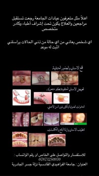 عيادة أسنان • قلع أسنان • طقم متحرك