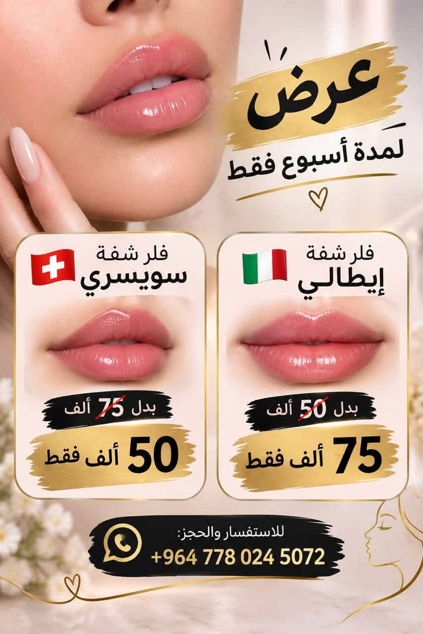 حي دجلة • فلر شفايف • عرض يومين