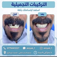 عيادة أسنان • تبييض • البصرة
