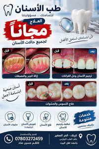 علاج أسنان مجاني • تنظيف وترميم • كربلاء
