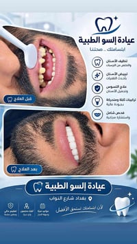 عيادة إلسو • تنظيف وتبييض • تقسيط ماستر