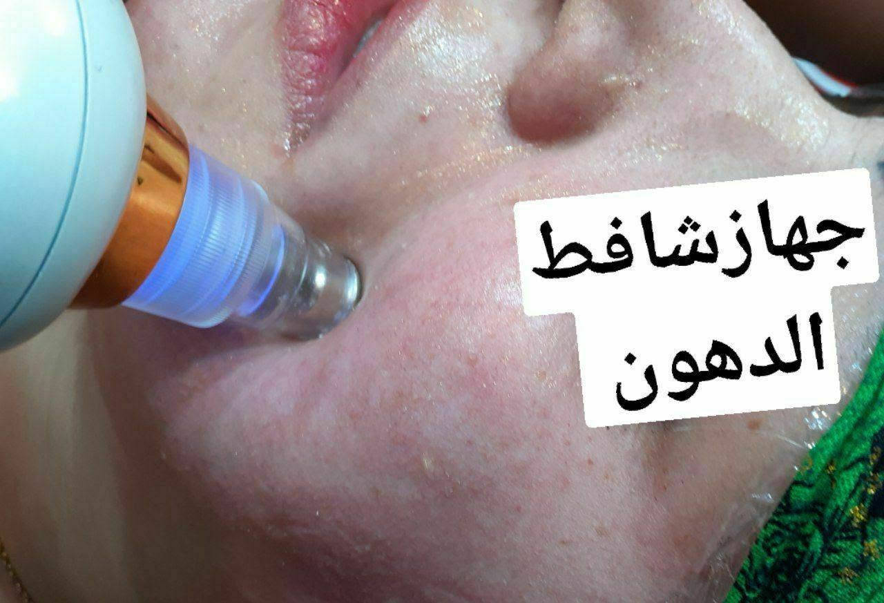 تنظيف بشرة • تبيض وترطيب • حي الحسين