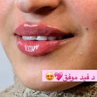 فيلر شفايف • نص سي سي • حي المعلمين