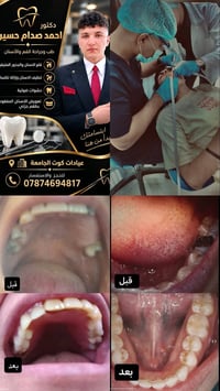 طب أسنان • قلع أسنان • عيادات كوت الجامعة