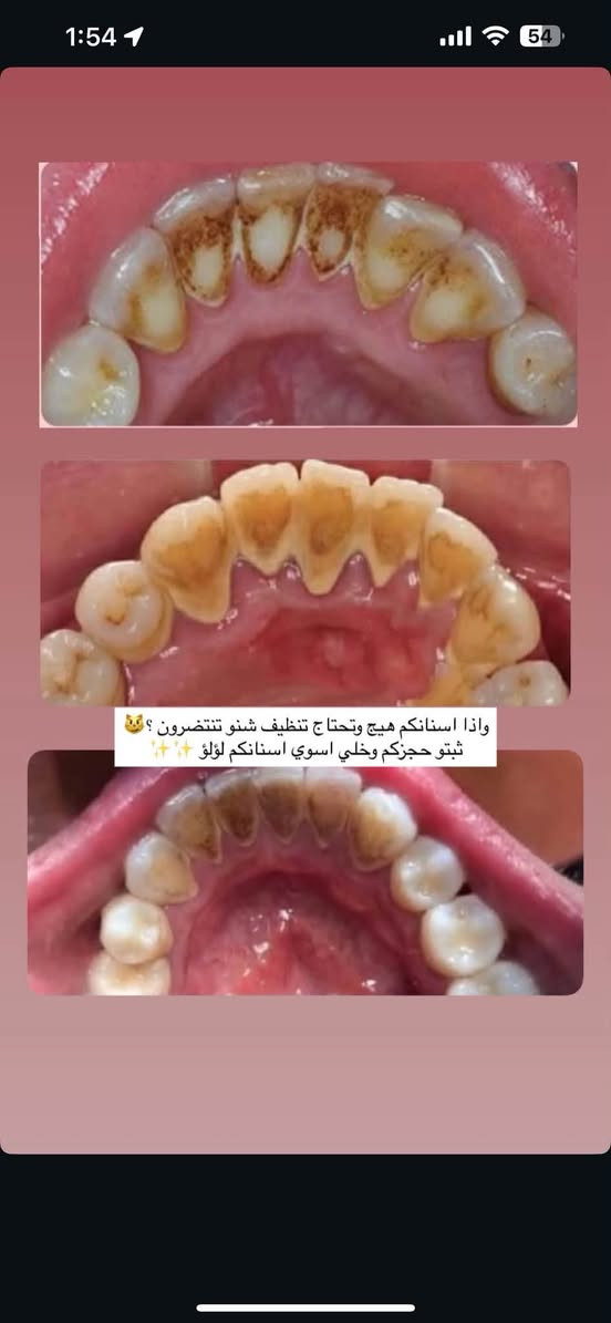 الدورة شارع المصافي • علاج اسنان مجاني • طقم اسنان مجاني
