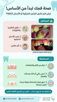 نقلع الجذور • مجاني • جامعة العين