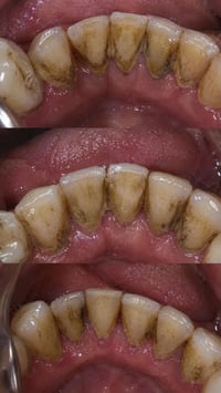 تنظيف اسنان • مجاناً • واتساب