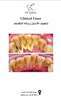 خدمات مجانية • حالات سريرية • جامعة كربلاء