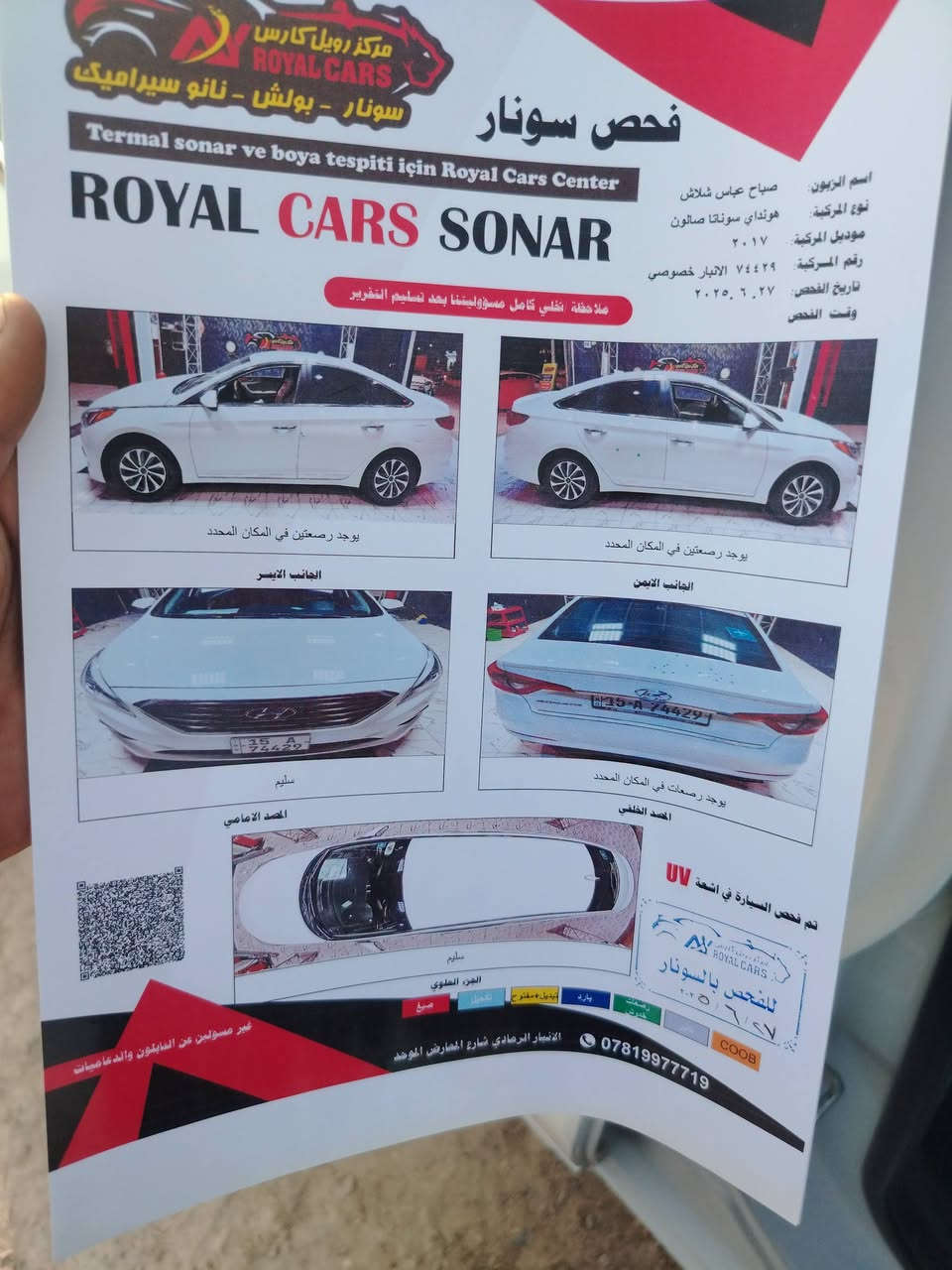 موديل 17رقم نبار نكليزي مكفوله كفاله عامه منكلشي مكفوله وارد مريكي قطرت  صبق مابيه علاشركه مامتعوبه مال جناي محرك مامفتوح بعده علا شركه تبريد ثلج مواصفات حلوه حيل تحويل مباشر سعر 135وبيه مجال مكان الأنبار عامريت الفلوجه ***********

نص مكتوب في الصور:
- مركز رويال كارس سونار - بولش - نانو سيراميك Sonal sonar ve boya tespiti için Royal Cars Center ROYAL CARS SONAR اسم الزبون: صباح عباس شلاش نوع المركبة: هونداي سوناتا صالون موديل المركبة: ٢٠١٧ رقم المركبة: ٧٤٤٢٩ الانبار خصوصي تاريخ الفحص: ٢٠٢٥/٦/٢٧ وقت الفحص ملاحظة: نخلي كامل مسؤوليتنا بعد تسليم التقرير يوجد رصعتين في المكان المحدد الجانب الايسر يوجد رصعتين في المكان المحدد الجانب الايمن سليم الصد الامامي يوجد رصعتين في المكان المحدد الصد الخلفي تم فحص السيارة في اشعة UV للفحص بالسونار ٢٠٢٥/٦/٢٧ COOB بارد رصعات خدوش تبديل + مفتوح تعديل صبغ الجزء العلوي سليم الأنبار الرمادي شارع المعارض الموحد *********** غير مسؤولين عن الدنابيون والدعاسات