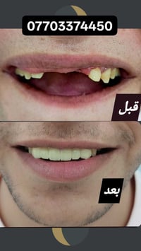 مشيرفة • صالون • صيدلية محمود