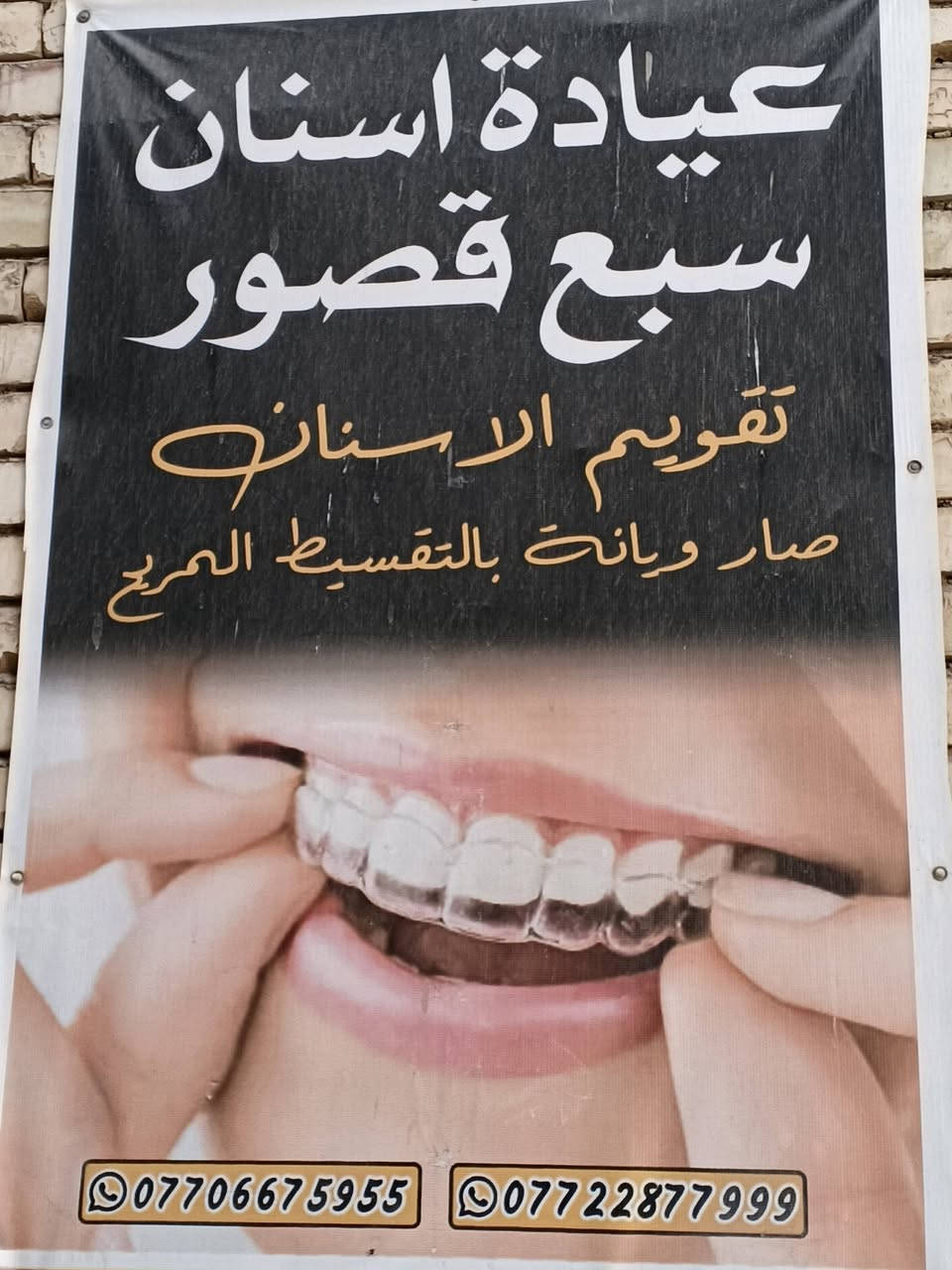 عيادة اسنان • سبع قصور • تقويم بالتقسيط
