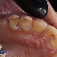 حشوات قديمة • تغليف ايماكس • المسيب