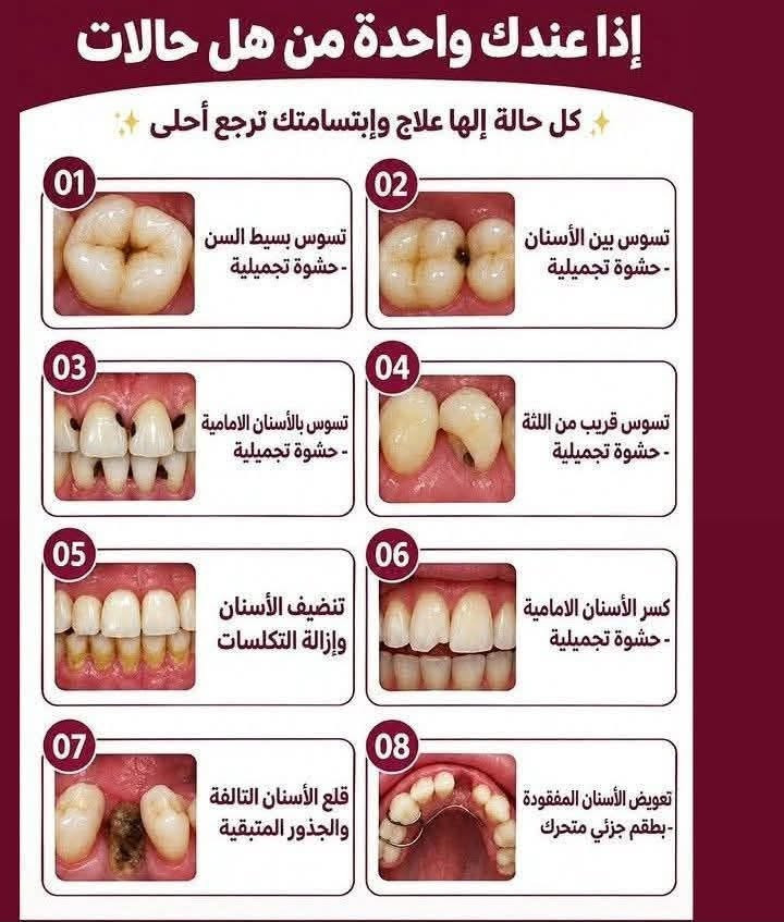 كربلاء الجمعيه • حشوات دائمة • علاج مجاني