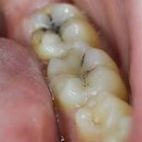 علاج مجاني • طقم متحرك • جامعة الهادي