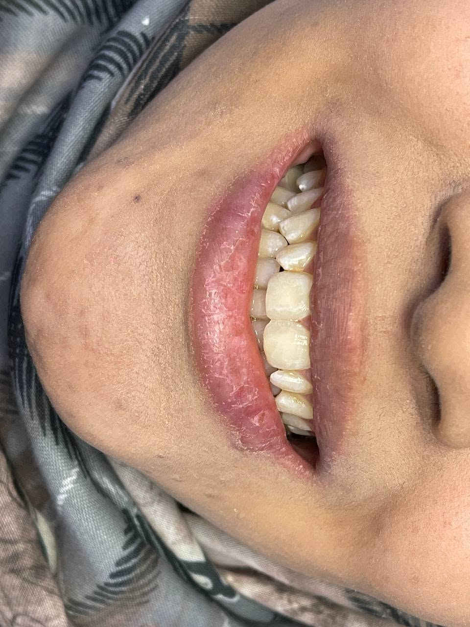 حشوات تجميلية للسنين القاطعة الامامية

د.طيبه علاء الزبيدي 
بكلوريوس طب وجراحة الفم والاسنان 
معيدة في الجامعة المستنصرية

نستقبلكم بكل حب يومياً من الساعة 5 إلى الساعة 10 مساءاً

للحجز والأستفسار الاتصال على الرقم ***********

العنوان #الطوبجي_مقابل_كوكتيل_البركة
