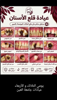 مجاناً • قلع الأسنان • حشوات ضوئية