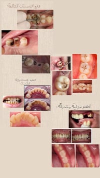 خدمات سنية مجانية • جامعة البيان • قلع وتنظيف