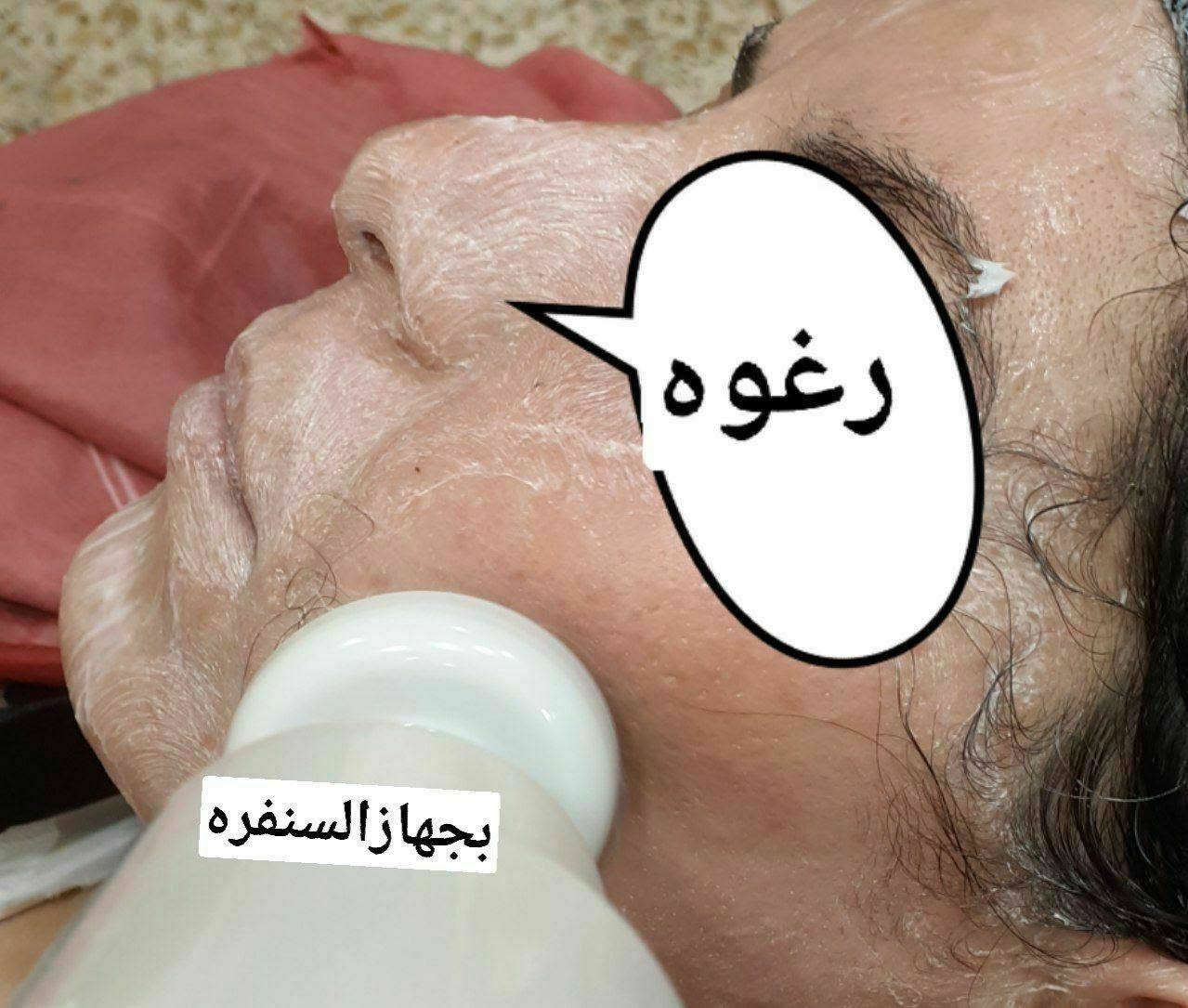 تنظيف بشرة • تبيض وترطيب • حي الحسين