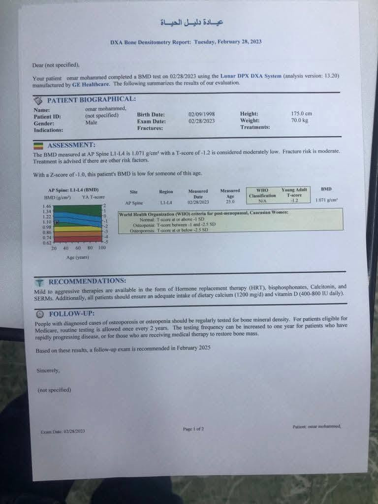 dexa scanللبيع
جهاز dexa scan 
فحص هشاشة العظام والكالسيوم 
موديل 2021 
صنع أمريكي Ge 
مواصفات Full body 
مع كامل محلقات الجهاز
للتواصل عبر الحساب أو الرقم 
***********
#المهندس_محمود_ابوذر_سالم موصل, نينوى
