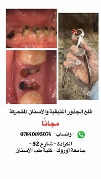 قلع الجذور • مجانا • الكرادة