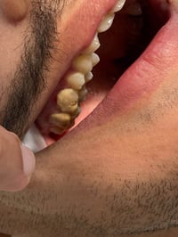 تنظيف أسنان • مجاني • جامعة البيان