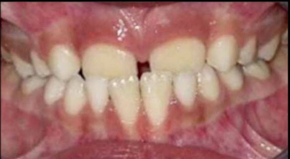 تقويم أسنان • مجاني • تحت إشراف اختصاصي