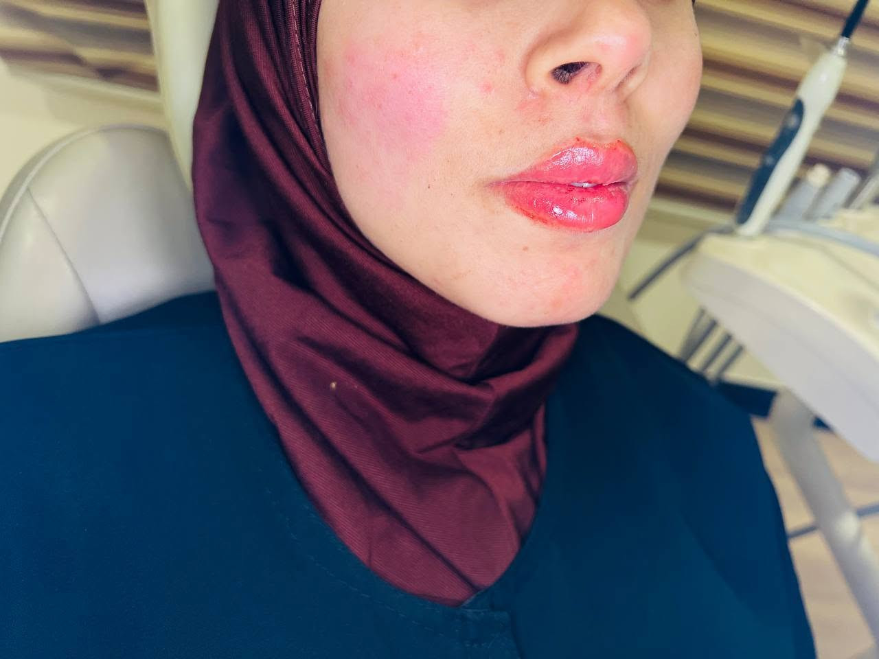 عيادة الدكتور وليد محمد الحمداني لطب الأسنان 🦷✅
هذا جزء بسيط من شغلنا 🔥🔥
للاستفسار أكثر مراسلة الصفحة ع الخاص 📲
او الاتصال على الرقم التالي *********** 📞
العنوان البياع شارع عشرين قرب دائرة الكهرباء مجمع البياع الطبي 🦷
