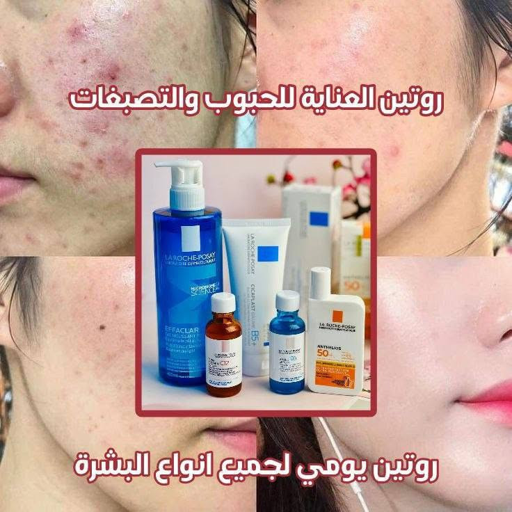 مساء الخير والعافية النجف, العراق

نص مكتوب في الصور:
- عرض تبييض وتفتيح وتوريد المناطق الحساسة
- كريم خلطة عراق كوين وكبسول فلر الزيتي ... عرض كوين للوجه مكس التسمين والتفتيح ...
- عرض سيرافي للبشرة الجافة والناشفة غسول زيتي مرطب ولوشن غني بالسيراميدات لحماية حاجز البشرة.
- عرض خاص للعناية بالبشرة الجافة والناشفة
- روتين العناية للحبوب والتصبغات روتين يومي لجميع انواع البشرة