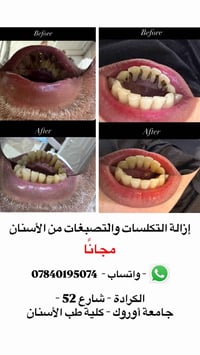 إزالة التكلسات • مجاناً • الكرادة شارع 52