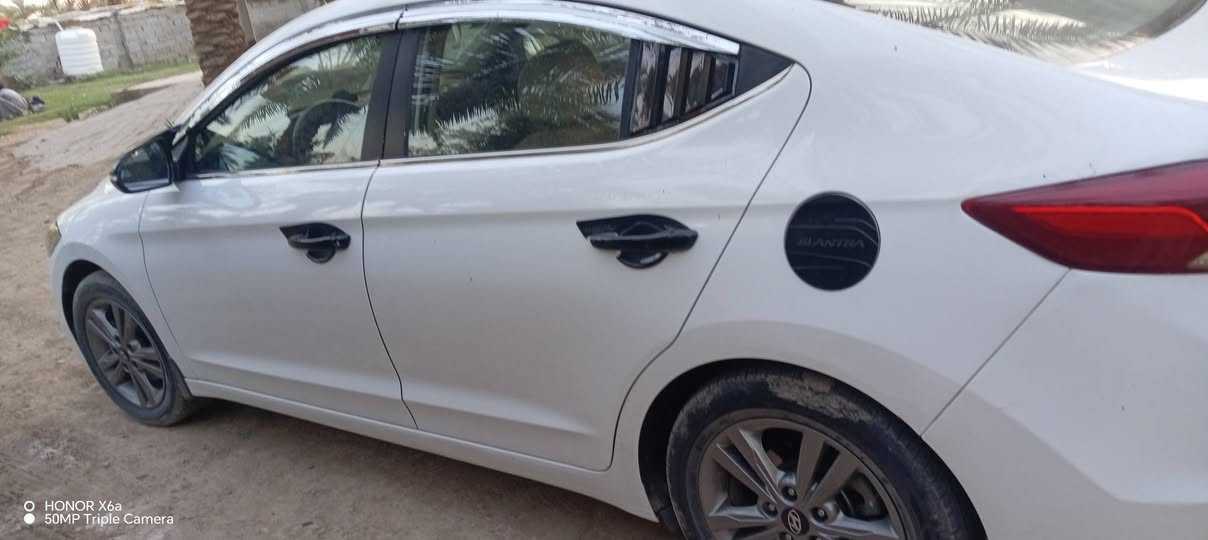 اسلام عليكم النترا 17خليجي
سونار موجود بالمنشور
سياره خير من الله
بأسمي سياره فول مواصفات ما عدا البصمه ***********
***********

نص مكتوب في الصور:
- HONOR X6a
- 50MP Triple Camera
- الجانب الايمن/ right side // صبغ ومعجون وبارد محدد + مرصعات وخدوش موضحه
- الجانب الايسر/ left sid // صبغ ومعجون وبارد محدد + مرصعات وخدوش موضحه
- بغداد / اليوسفية / الشارع العام / مقابل معارض اليوسفية
- الجانب السطحي/ surface side // مرصعات موضحه
- ة الخلفية/ back side// بارد محدد + مرصعات وخدوش موضحه
- داد / اليوسفية / الشارع العام / مقابل معارض اليوسفية