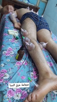 حجامة • علاج طبيعي • حي الصدرين
