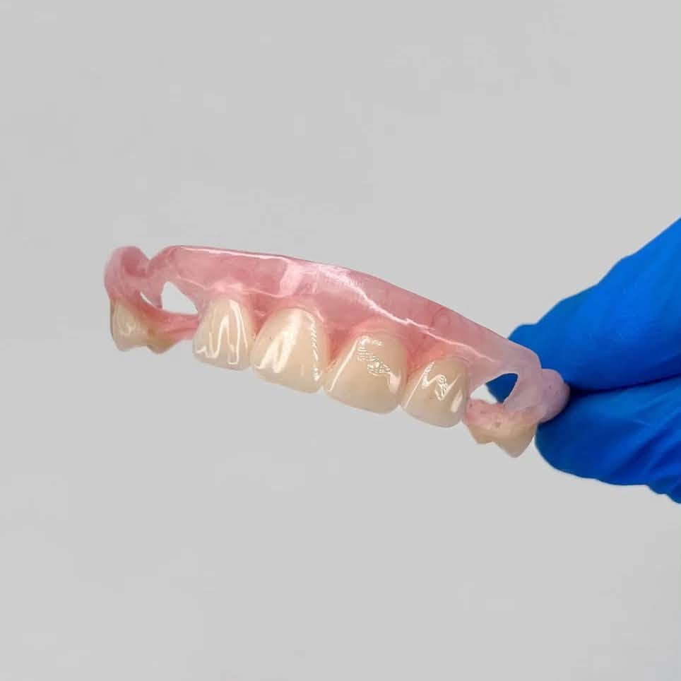 السلام عليكم 
اي احد يحتاج حشوة اسنان تجميلية
قلع اسنان او جذور متبقية، تنظيف اسنان، طقم اسنان متحرك جزئي او كامل
يراسلني على هذا الرقم
***********
العلاج في جامعة التراث تحت إشراف اطباء اسنان اختصاص

نص مكتوب في الصور:
- before | قبل
- after | بعد