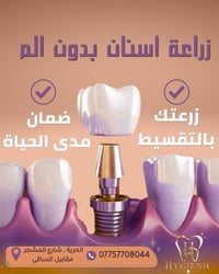 زراعة أسنان • ضمان مدى الحياة • الحرية