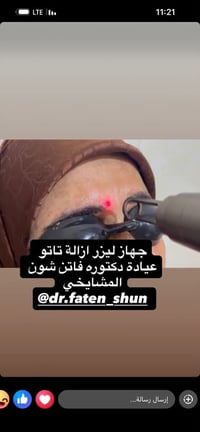 فاتن شون المشايخي • جلدية تجميلية • تساقط شعر