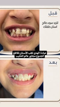 عيادة الهدى • أسنان وتجميل • تقاطع الجدوع