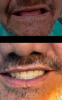 طقم متحرك كامل • حشوات تجميلية • قلع أسنان