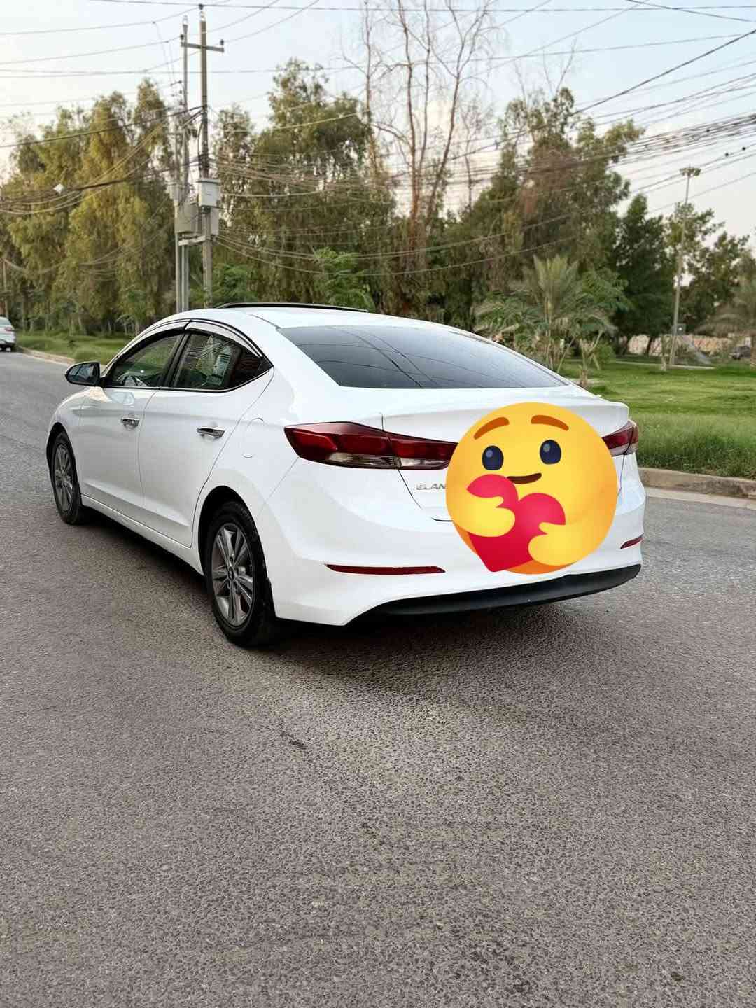 النتره • ٢٠١٧ • مكينة مكفولة