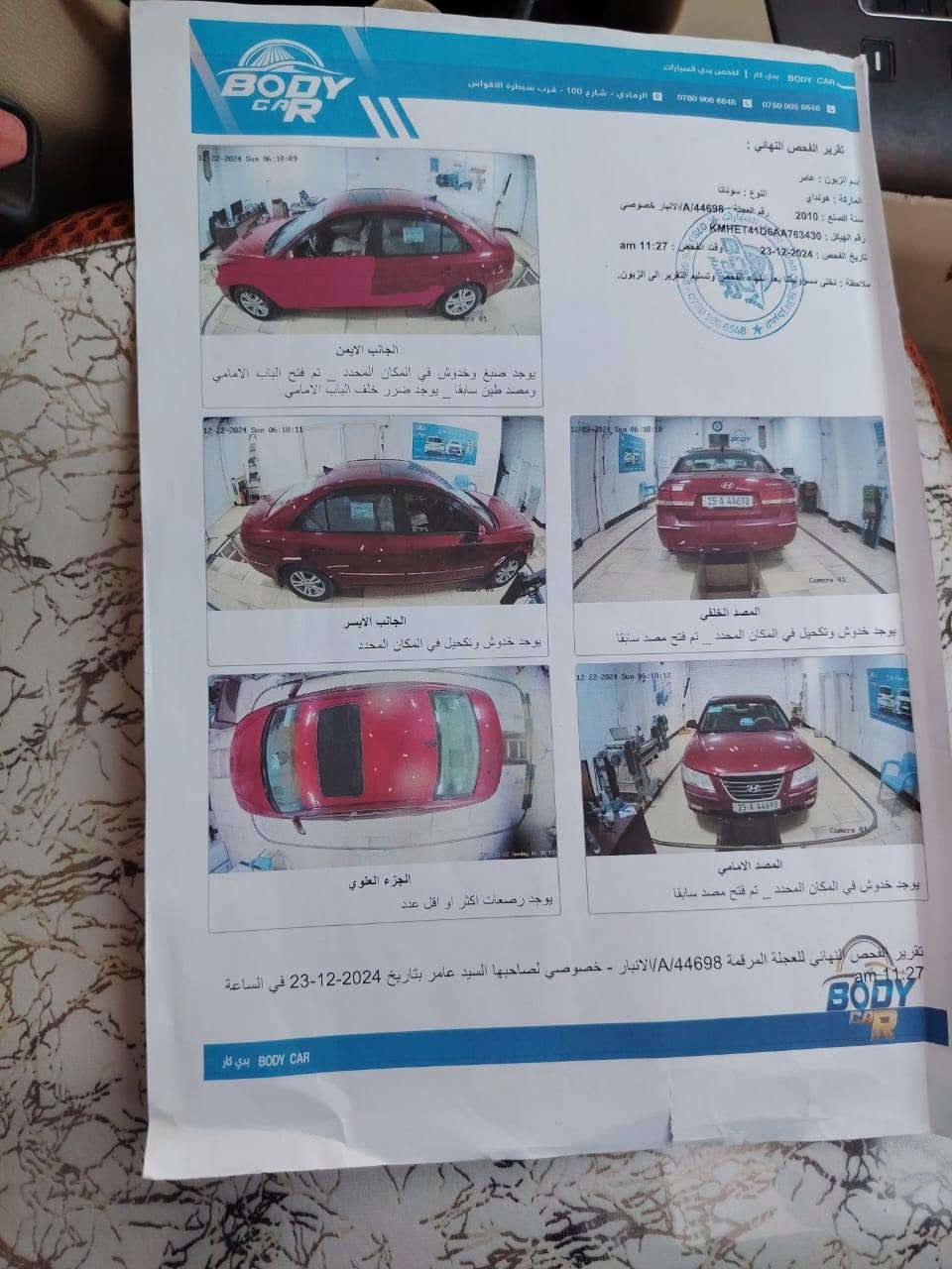 🚨 بيع سريع ومستعجل 🚨
🚘 هيونداي سوناتا 2010 خليجي 🔹 محرك 2.4 🔹 فول مواصفات 🔹 الكير والمحرك شرط 🔹 السيارة باسمي والتحويل مباشر 🔹 شرط بدون معجون 🔹 بدون حادث 🔹 صبغ فقط آثار شخوط 🔹 السونار موجود بالمنشور
💰 السعر: 105 ورقة
📞 للاستفسار: ***********
