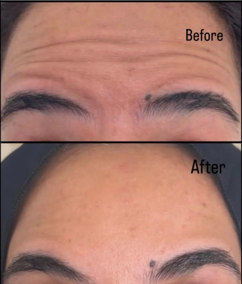 السلام عليكم 🌷
وياكم دكتورة زهراء 🤍

✨ جايتكم بعروض شهرية مميزة ✨

💉 فلر
💉 بوتكس
💉 إبر النضارة
✨ وتغيير شامل

العروض لمدة أسبوعين فقط ⏳
وبأسعار مناسبة ومميزة 🤍

📲 للحجز والاستفسار واتساب:
***********

📸 الإنستغرام:
dr_zeo.0

✨ لا تفوتكم عروض هذا الشهر ✨
