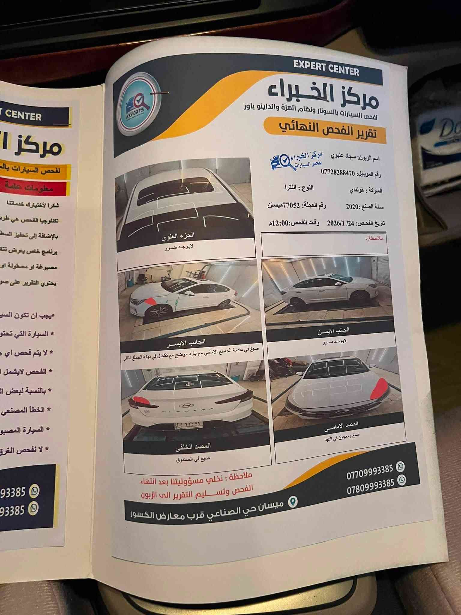 السلام عليكم الانترا 2020 حره بيها بارد موضح بالسونار سعرها 162 وبيها مجال
ميسان الكحلاء ***********
