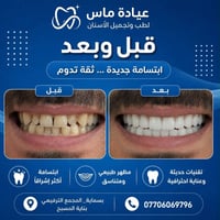 عيادة أسنان • تبييض وتنظيف • بسماية