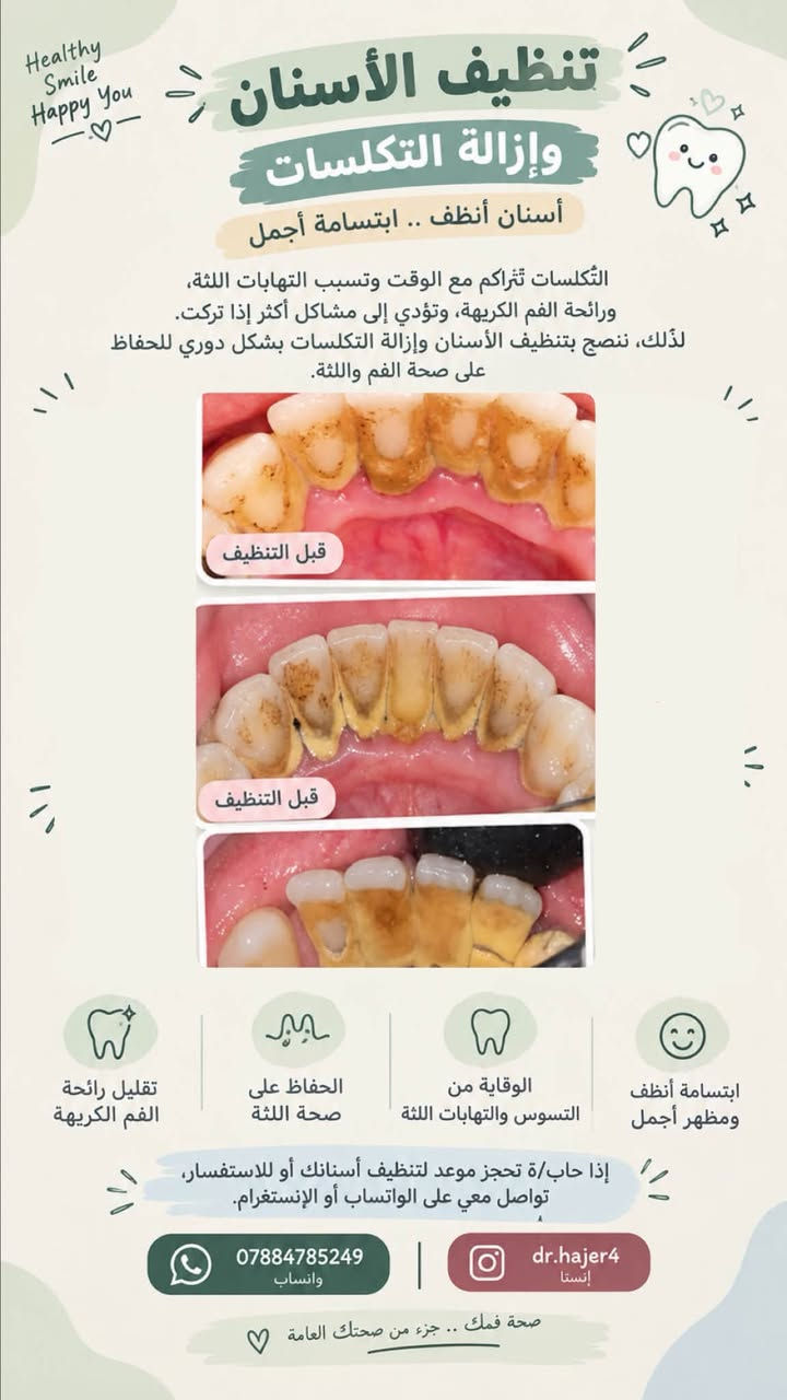 علاج أسنان • مجاني • بغداد شارع المطار