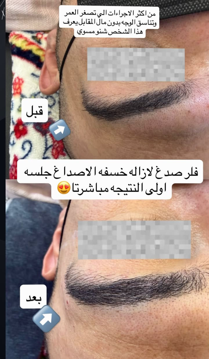ننتضركم يوميا في عيادة كنز الابتسامه من الساعه ٥ للساعه ٩ مساءا للحجز والاستفسار واتس *********** عنوان العيادة نزلة گميره فوق صيدليه ليث صباح مقابل علوة ابو محمد
