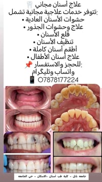 علاج أسنان مجاني • كلية طب الأسنان • علاج أطفال