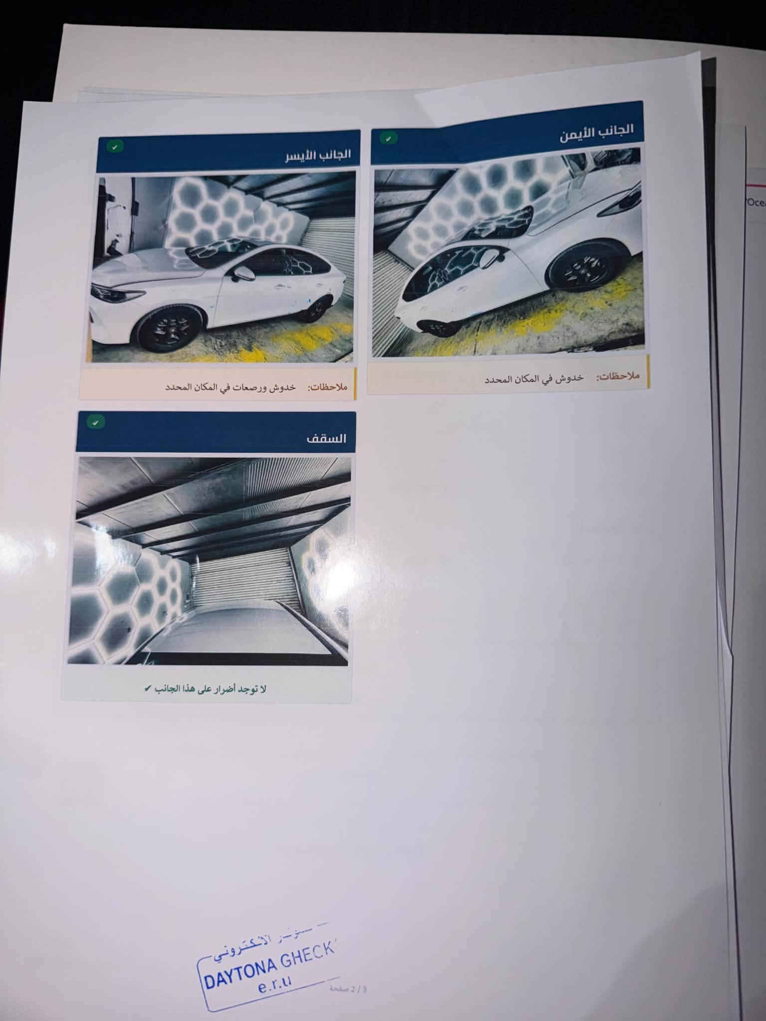 كن بلاس • كفالة ٢٠٢٥ • ٢ رصعات