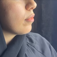 ابتسامتج • شفايفج • دكتورة ساره عدنان