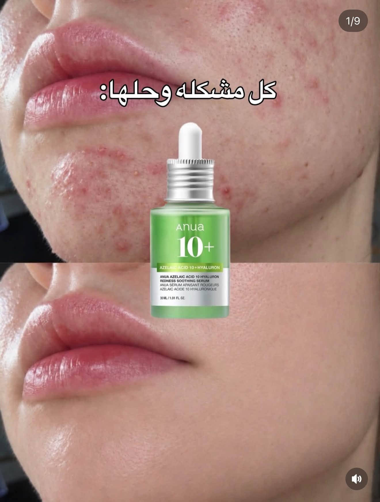 تخفيضات جملة • أصلي ضمان • CADY BEAUTY